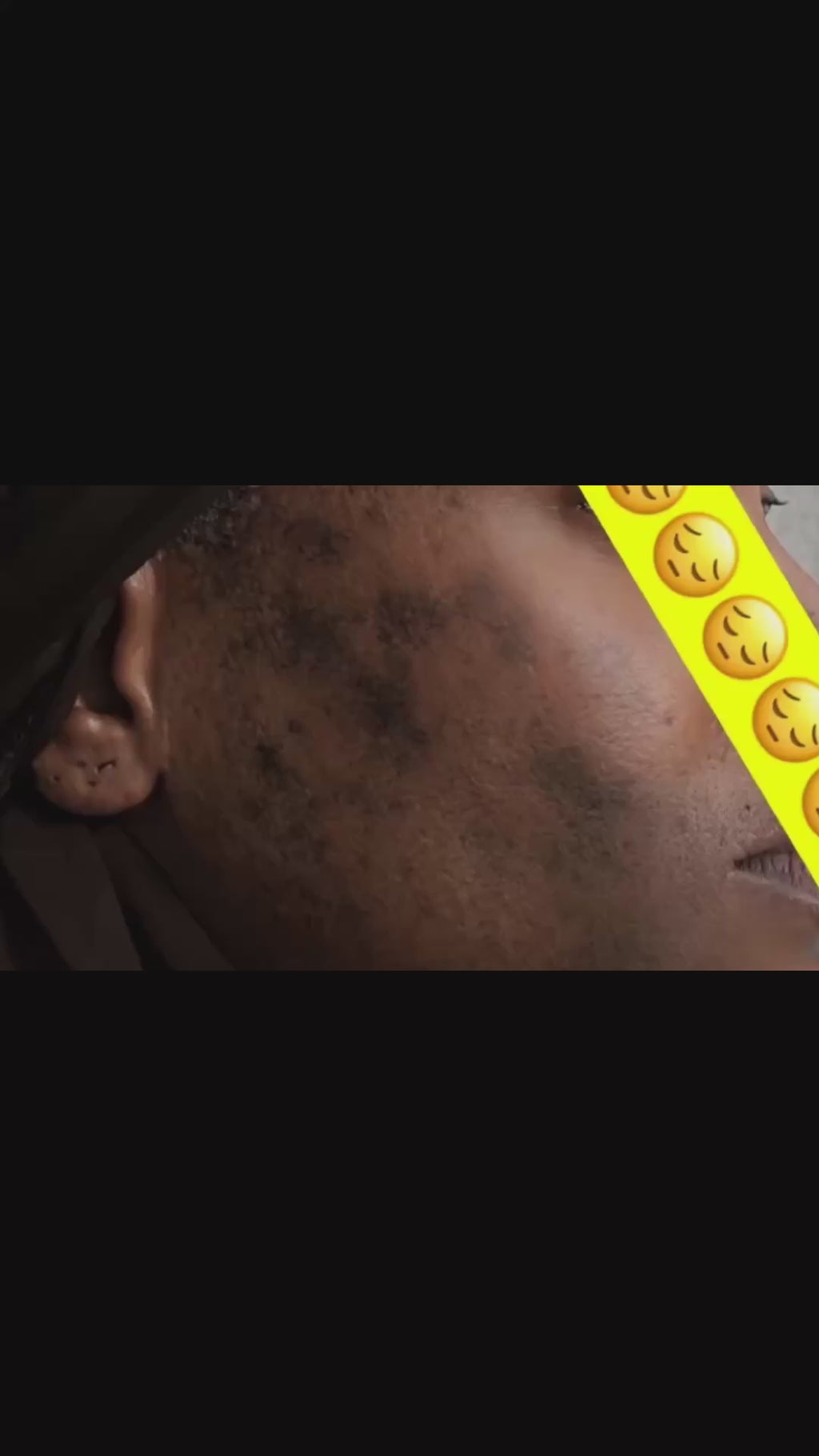 Sérum intensif Tâche